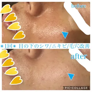 ロング カラー パーマ ヘアアレンジ キッズ ネイル マツエク・マツパ EnsorClair 代表 野口真央のエステ・リラクイメージ