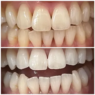 メンズ DIAMOND BEAUYのその他イメージ