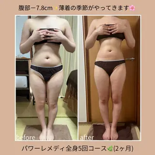《本気痩せ×疲労改善 》  BILOOPのエステ・リラクイメージ