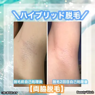 痩身/脱毛/ネイル HARUKAのエステ・リラクイメージ