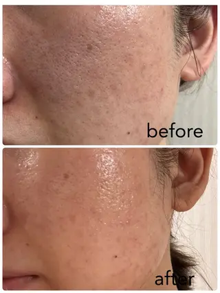 HISUI所属・IVY化粧品・ 勝山亜優奈のその他イメージ