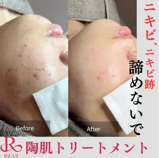beauty salonWのエステ・リラクイメージ