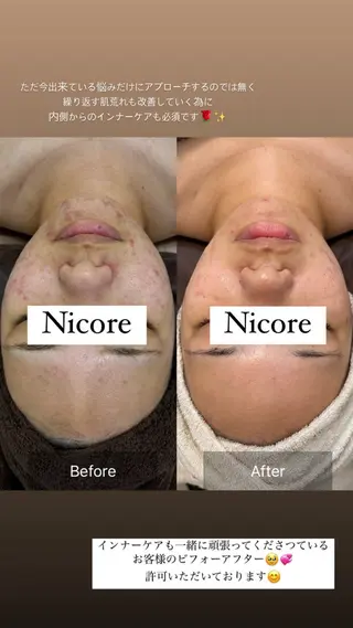 Nicore所属・肌質改善🌿まつ毛 chapiのその他イメージ