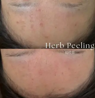 佐藤 加奈のエステ・リラクイメージ