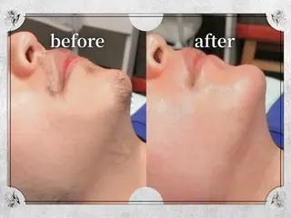 都度払い脱毛 Lino柏/Moneのエステ・リラクイメージ