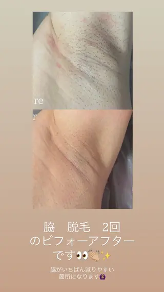 KARIN/りあみか /眉毛/まつげ/脱毛のマツエク・マツパデザイン