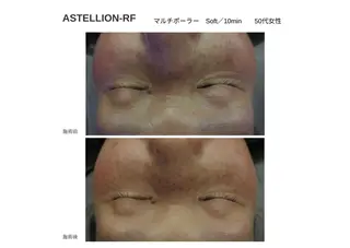 シルフィア｜ 小顔／深層マッサージのエステ・リラクイメージ