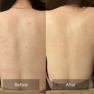 for woman所属・森 美優のエステ・リラクイメージ