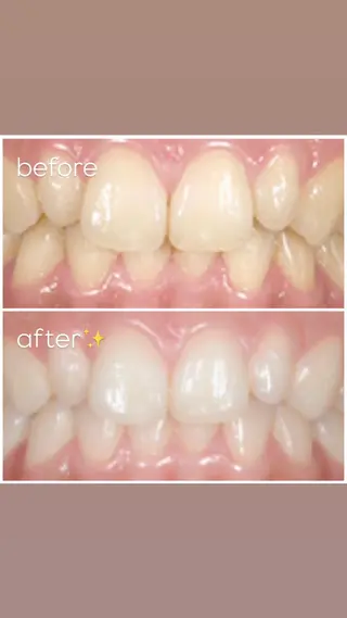 エクシア津駅前店所属・セルフホワイトニング エクシア津駅前店のその他イメージ