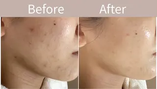 都度払い 肌質改善専門サロンのエステ・リラクイメージ