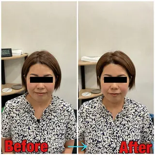 小顔矯正・美容鍼 FLOW鍼灸整体院のエステ・リラクイメージ