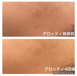 ルラーシュ　店長 日置美幸のエステ・リラクイメージ