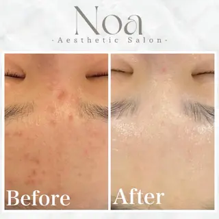 肌質改善サロン Noaのエステ・リラクイメージ