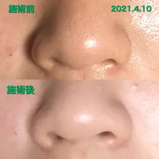 La.pport ラポールのエステ・リラクイメージ