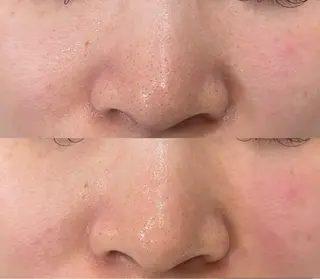 小林 玲菜のエステ・リラクイメージ