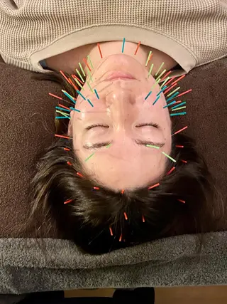 美容鍼灸サロン YOSHINOのエステ・リラクイメージ