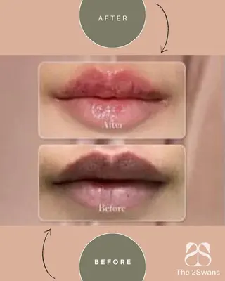 The 2Swans フェイシャル サロンのエステ・リラクイメージ