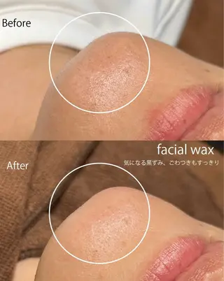 Oak所属・【 Oak 】 -ERIKOのエステ・リラクイメージ