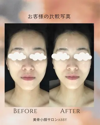小顔コルギ💎 ABBY SANOのエステ・リラクイメージ