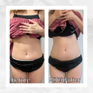 部分痩せ♥️小顔専門 MIKUのエステ・リラクイメージ