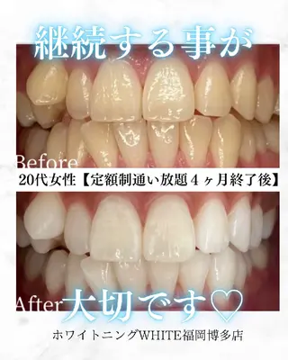 メンズ キッズ セルフホワイトニング WHITE福岡博多店のエステ・リラクイメージ