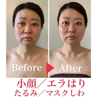 ミディアム カラー パーマ ヘアアレンジ メンズ キッズ ネイル マツエク・マツパ さくら夙川駅徒歩3分 最新韓国施術|脚やせのエステ・リラクイメージ