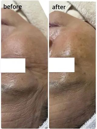 【たるみケア/毛穴引 き締め/よもぎ蒸し】のエステ・リラクイメージ