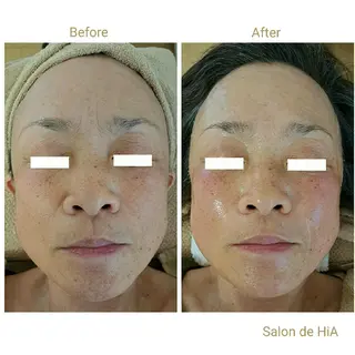 Salon de  HiAのエステ・リラクイメージ