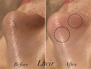 脱毛＆小顔コルギ 専門店 Lucirのエステ・リラクイメージ