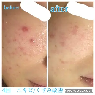 ロング カラー パーマ ヘアアレンジ メンズ キッズ ネイル マツエク・マツパ EnsorClair 代表 野口真央のエステ・リラクイメージ