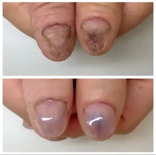 ネイル ネイルサロンアリューム所属・ネイルサロン アリュームのネイルデザイン