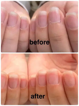 ネイル 竹本 恵美のネイルデザイン