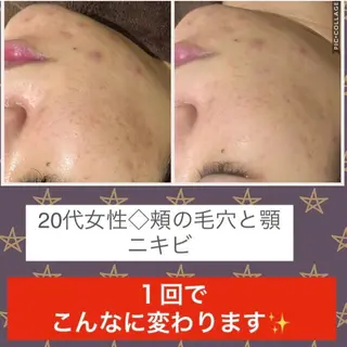 ミディアム カラー パーマ ヘアアレンジ メンズ キッズ ネイル マツエク・マツパ ニキビ・肌質改善専門 ♡人生が変わるサロンのエステ・リラクイメージ