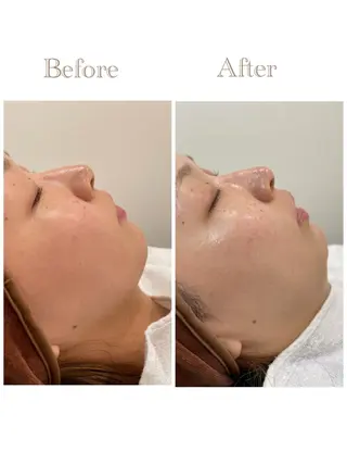 お肌の角質ケア / ベラステギのその他イメージ