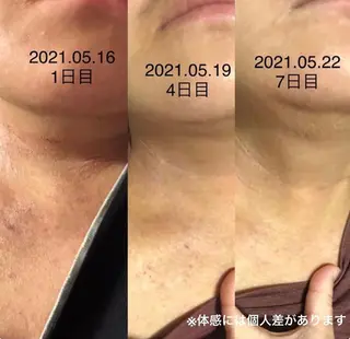 tominaga ryokoのヘアスタイル