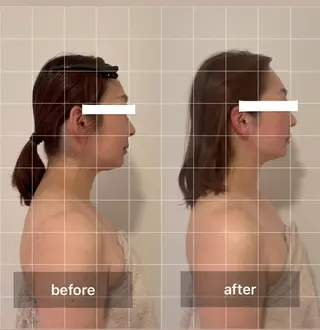 エクラヴィ 小顔・エイジングケアのエステ・リラクイメージ