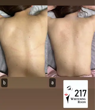 217 ホワイトニングルームのエステ・リラクイメージ