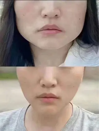 ネイル aliaハーブ水光店 エステティシャン募集のエステ・リラクイメージ