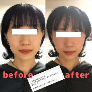 星| 小顔矯正/骨盤矯正のエステ・リラクイメージ