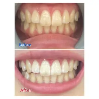 Ｍ渋谷 ホワイトニングのエステ・リラクイメージ