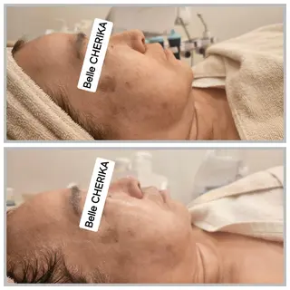 ベル チェリカ 三城のエステ・リラクイメージ