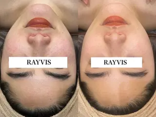 🖤RAYVIS🖤 青森店　和田のエステ・リラクイメージ