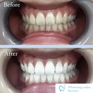ホワイトニングサロン fascimo新座店のその他イメージ