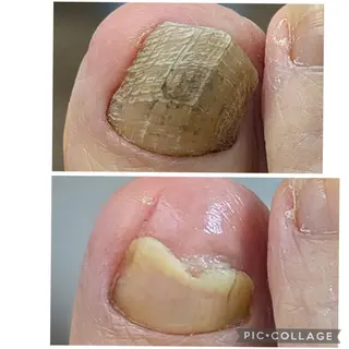 ネイル 爪の病院屋さん所属・安野 真理愛のネイルデザイン