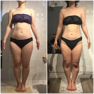 痩身・フェイシャル エステサンテボーテのエステ・リラクイメージ