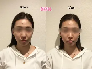 チキバン美容鍼灸整体 サロン心斎橋店のエステ・リラクイメージ