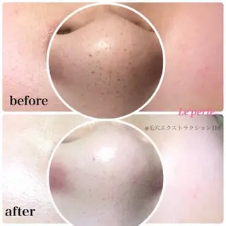 Le'perle。所属・Le'perle。 Kyokaのエステ・リラクイメージ