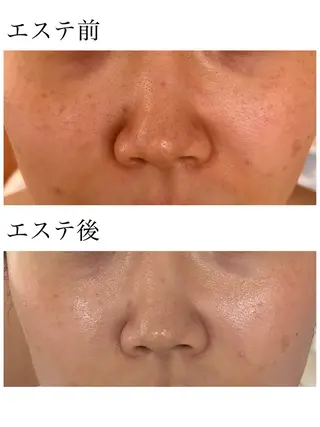 YUI🤍乾燥ゆらぎ 肌🌿即透明感✨のエステ・リラクイメージ