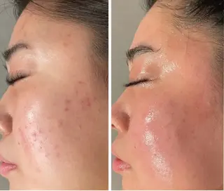 エステ／ネイル/脱毛 R.Msalonのネイルデザイン