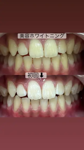ホワイトニングサロン yatto.のその他イメージ